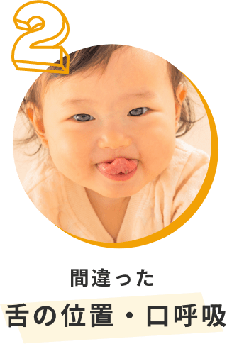 間違った舌の位置・口呼吸