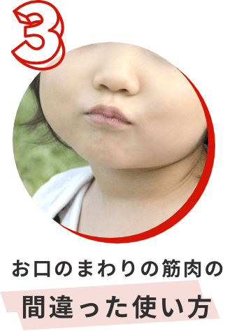お口のまわりの筋肉の間違った使い方